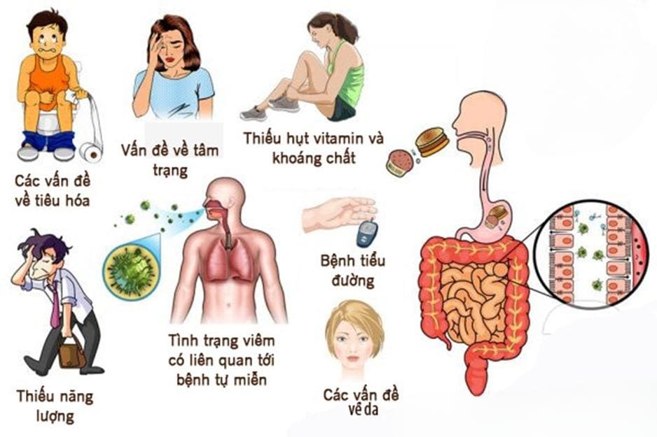 Nguyên Nhân Gây Vấn Đề Tiêu Hóa