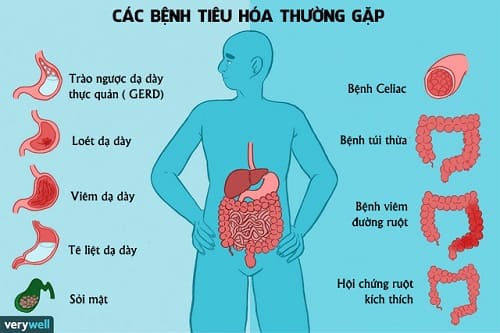Những Vấn Đề Tiêu Hóa Phổ Biến