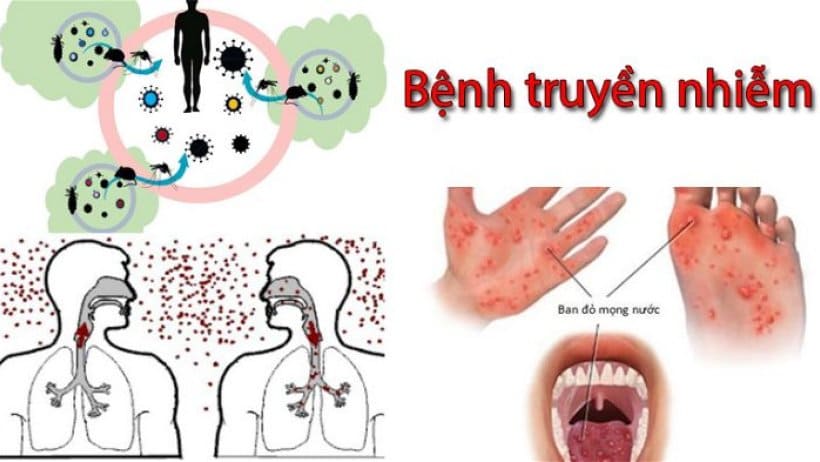 5 Bí Quyết Phòng Bệnh Truyền Nhiễm Bảo Vệ Sức Khỏe Hiệu Quả