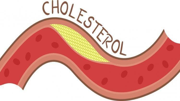 Mẹo Thực Tiễn Để Giảm Cholesterol Hiệu Quả