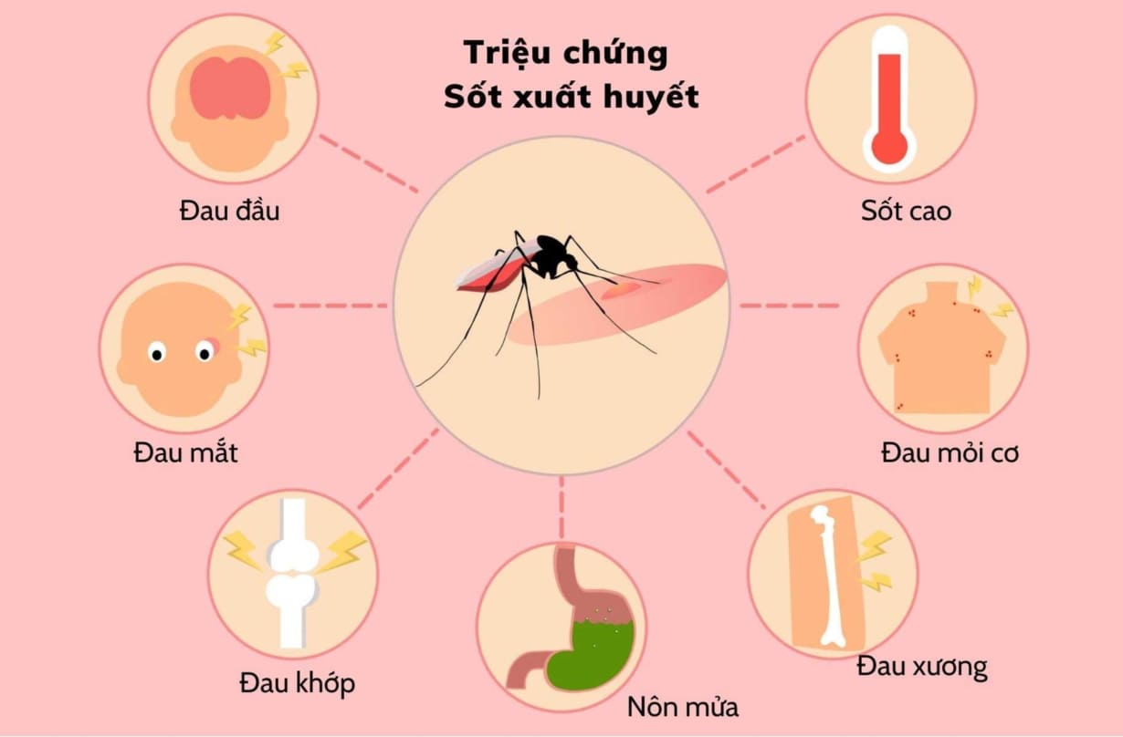 Nhận Biết Sớm Và Xử Lý Khi Nghi Nhiễm Bệnh Sốt Xuất Huyết